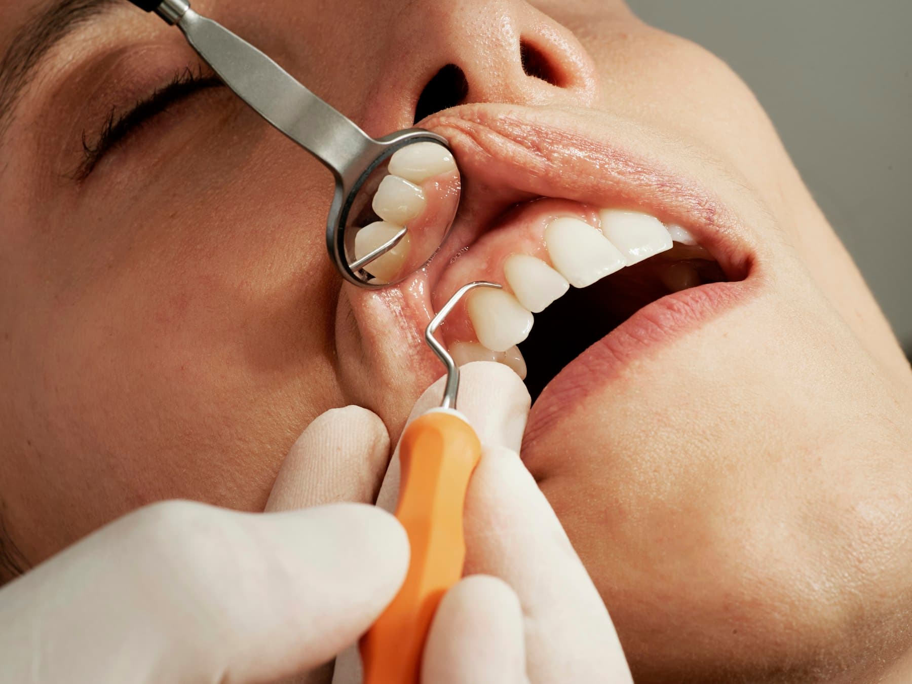 Tandhygienist undersöker en patients tänder med spegel och sond